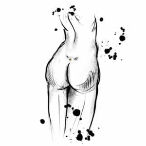 Andere implantat am steissbein 300x300