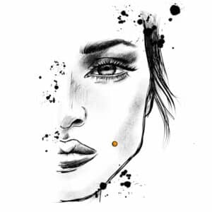 Mund cheek dermal 300x300